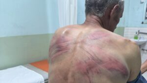 PIK preporučio suspenziju dvojice policajaca zbog prebijanja Nenada Raškovića